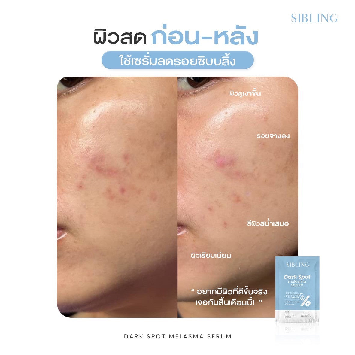 Sibling Dark Spot Melasma Serum 15ml