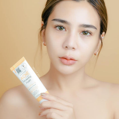 VC Vitamin C Acne White Foam 50g