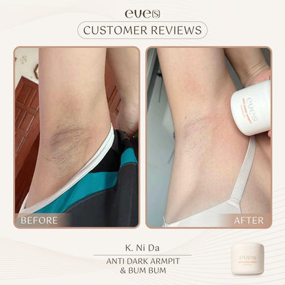 EVE’S ANTI DARK ARMPIT & BUM BUM 50g