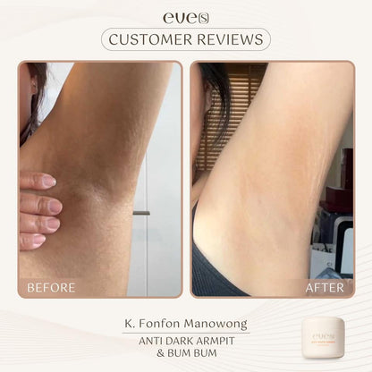 EVE’S ANTI DARK ARMPIT & BUM BUM 50g