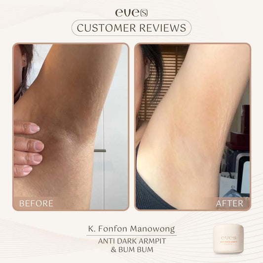 EVE’S ANTI DARK ARMPIT & BUM BUM 50g