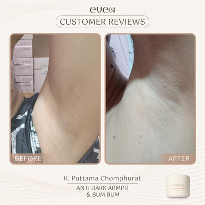 EVE’S ANTI DARK ARMPIT & BUM BUM 50g