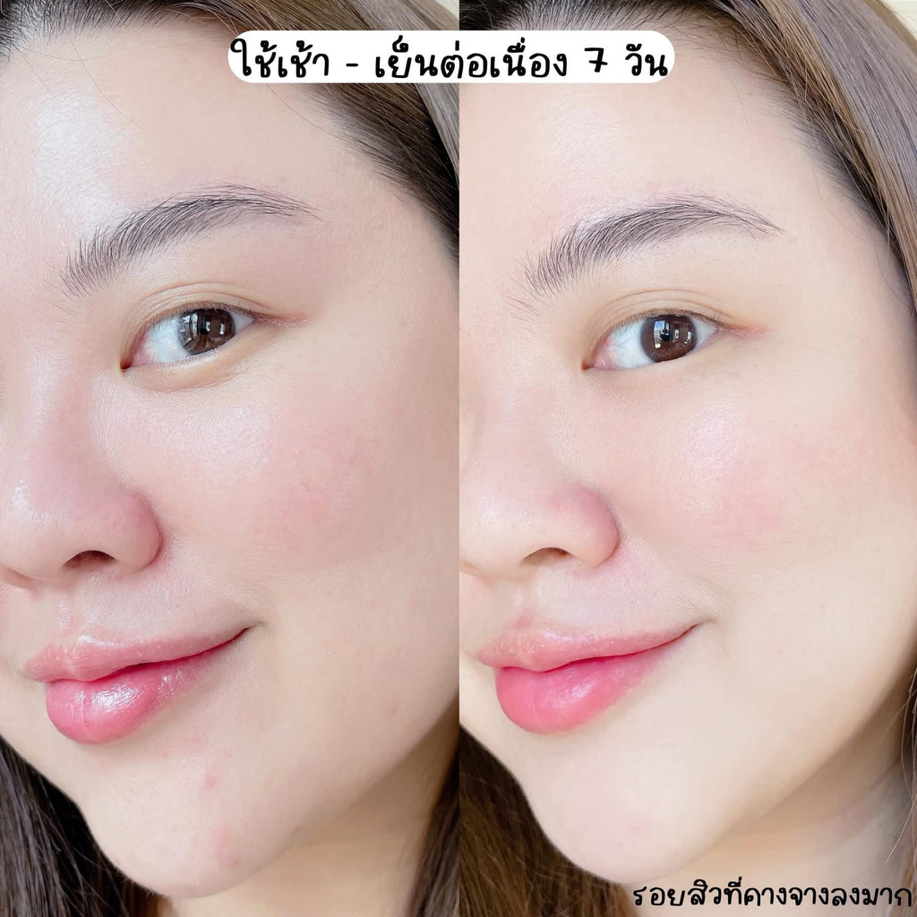 The Charming Garden Dragon’s Blood Facial Gel 7g