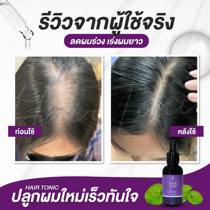 CHABA Hair Tonic new package 35ml