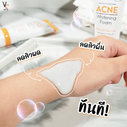 VC Vitamin C Acne White Foam 50g
