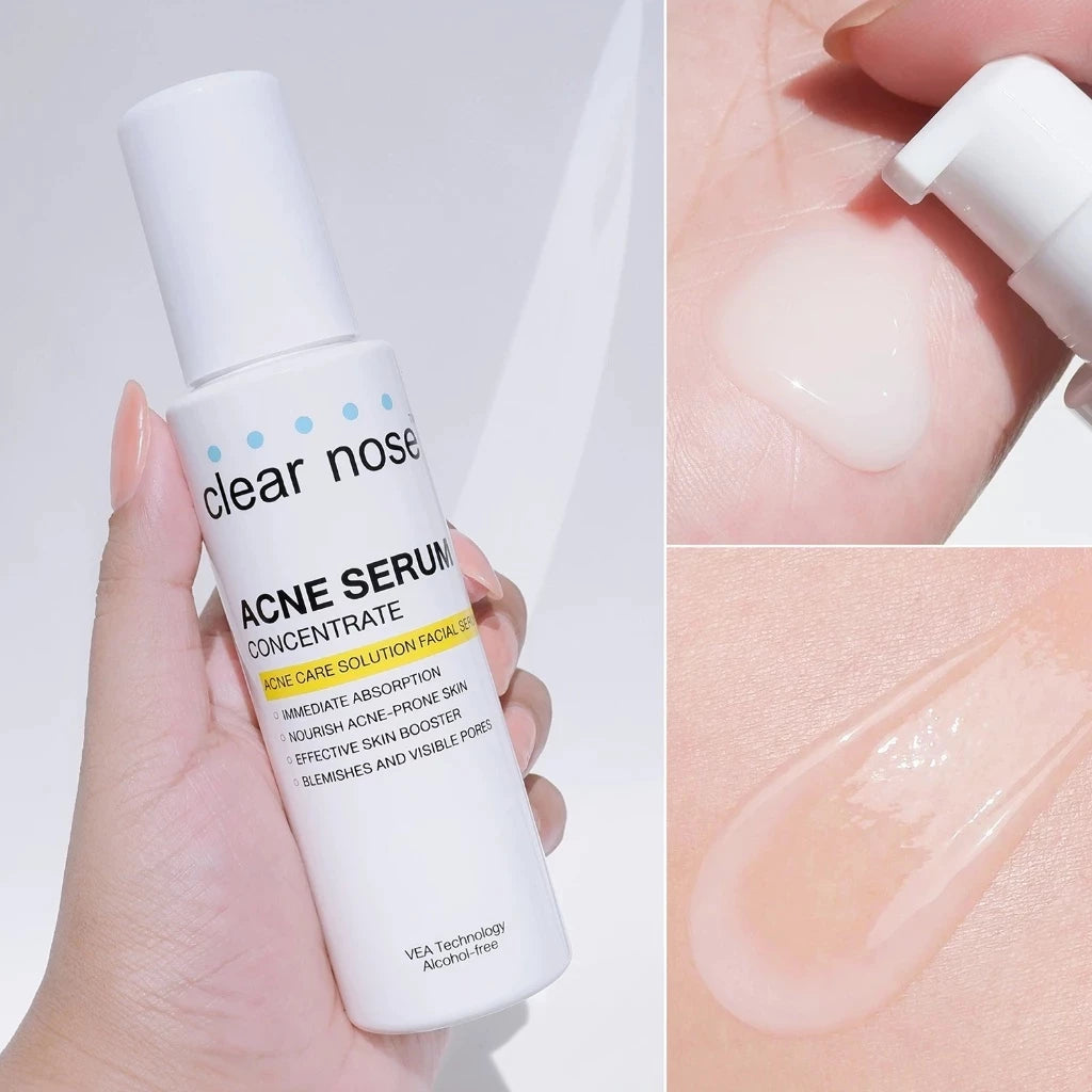 CLEAR NOSE - Acne Care Solution Facial Serum 100ml