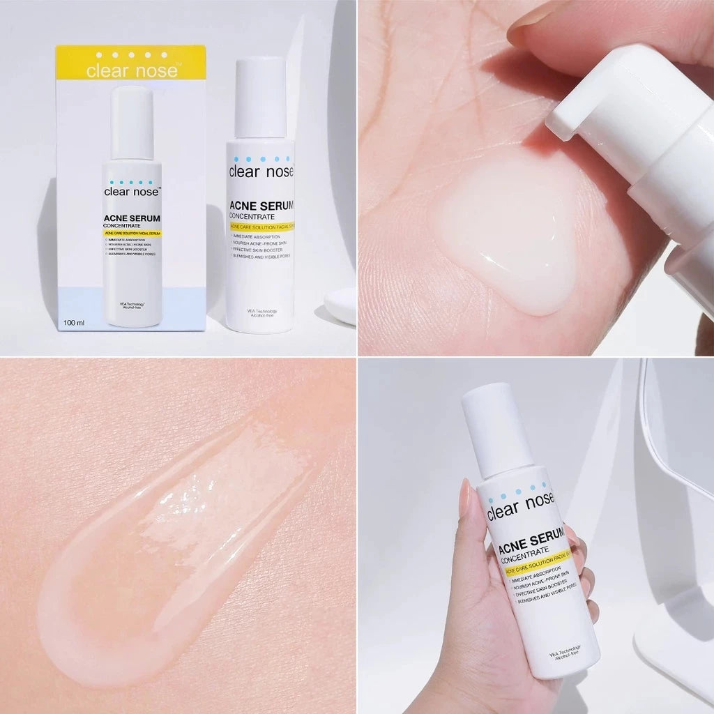 CLEAR NOSE - Acne Care Solution Facial Serum 100ml