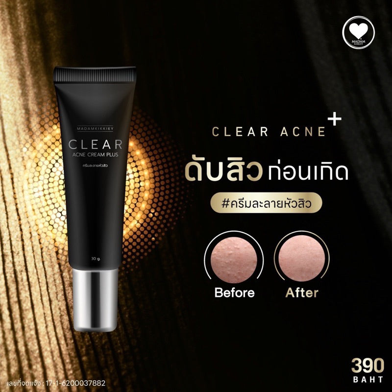 MADAMKIKKIEY Clear Acne Cream Plus 30 g