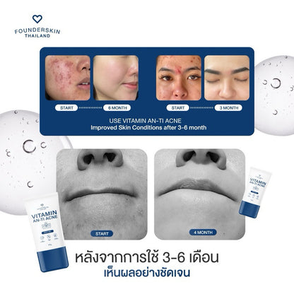 FounderSkin VITAMIN AN-TI ACNE 10g